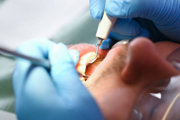 Best Urgent Care for Lost Fillings or Crowns in Oak Leaf, TX